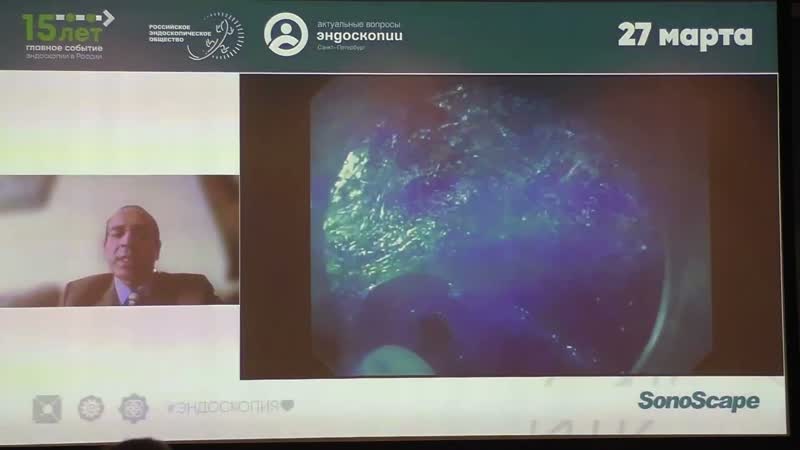 2024 03 27 Endo BRICS Kareem Essam MD Egyptian Experience in using Sono Scape in Third Space