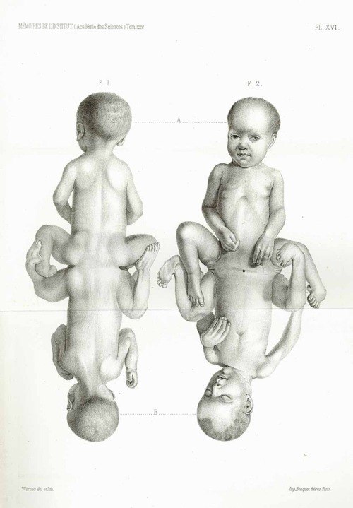 Vlad Go | Северодвинск