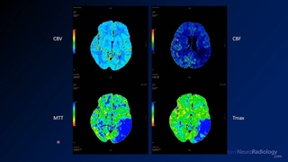 Neuroradiology board review 2 case 14