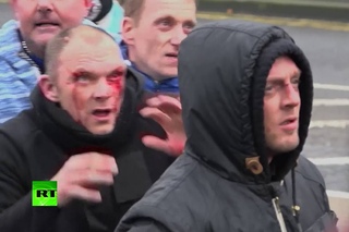 Антимиграционный митинг в Дувре перерос в драку с участниками протеста в поддержку беженцев